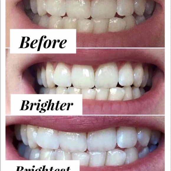 Teeth Whitening Toothpaste - Picture 2 of 2